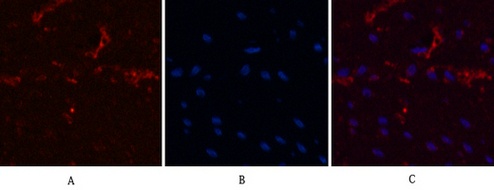 Fig.2. Immunofluorescence analysis of human colon cancer tissue. 1, α-tubulin Monoclonal Antibody (3G5) (red) was diluted at 1:200 (4°C, overnight). 2, Cy3 Labeled secondary antibody was diluted at 1:300 (room temperature, 50min). 3, Picture B: DAPI (blue) 10min. Picture A: Target. Picture B: DAPI. Picture C: merge of A+B.