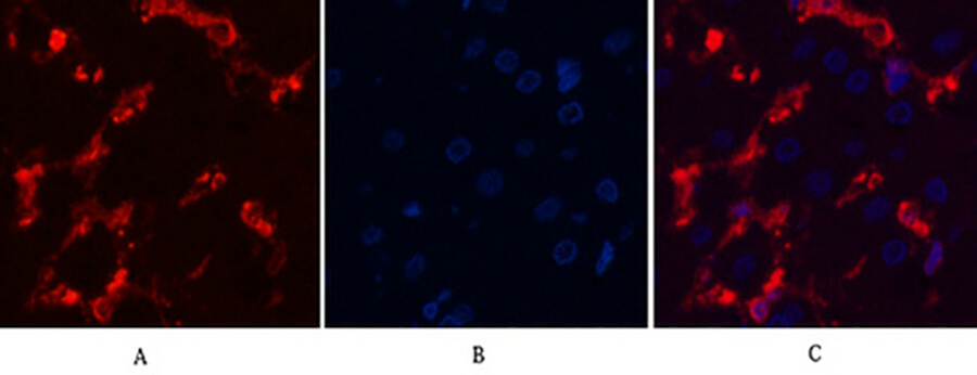 Fig.2. Immunofluorescence analysis of human liver tissue. 1, α-SMA Monoclonal Antibody (red) was diluted at 1:200 (4°C, overnight). 2, Cy3 Labeled secondary antibody was diluted at 1:300 (room temperature, 50min). 3, Picture B: DAPI (blue) 10min. Picture A: Target. Picture B: DAPI. Picture C: merge of A+B.