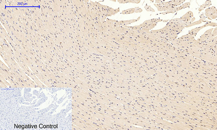 Fig.4. Immunohistochemical analysis of paraffin-embedded rat heart tissue. 1, GSK3β (phospho Ser9) Polyclonal Antibody was diluted at 1:200 (4°C, overnight). 2, Sodium citrate pH 6.0 was used for antibody retrieval (>98°C, 20min). 3, secondary antibody was diluted at 1:200 (room temperature, 30min). Negative control was used by secondary antibody only.