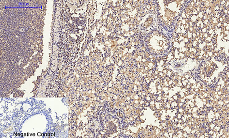 Fig.5. Immunohistochemical analysis of paraffin-embedded mouse lung tissue. 1, ERK 1/2 Polyclonal Antibody was diluted at 1:200 (4°C, overnight). 2, Sodium citrate pH 6.0 was used for antibody retrieval (>98°C, 20min). 3, secondary antibody was diluted at 1:200 (room temperature, 30min). Negative control was used by secondary antibody only.