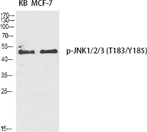 Fig.1. Western Blot analysis of KB (1), MCF-7 (2), diluted at 1:2000.