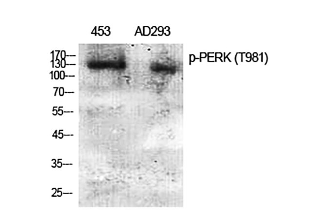 Fig.1. Western Blot analysis of 453(1), AD293(2), diluted at 1:2000.