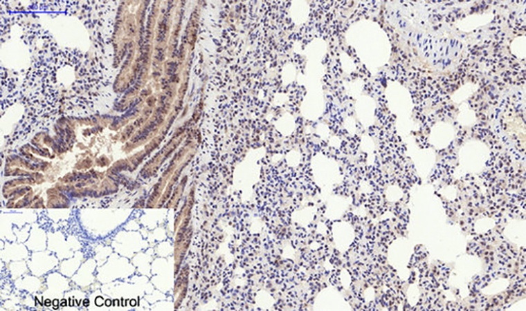 Fig.5. Immunohistochemical analysis of paraffin-embedded rat lung tissue. 1, PERK (phospho Thr981) Polyclonal Antibody was diluted at 1:200 (4°C, overnight). 2, Sodium citrate pH 6.0 was used for antibody retrieval (>98°C, 20min). 3, secondary antibody was diluted at 1:200 (room temperature, 30min). Negative control was used by secondary antibody only.