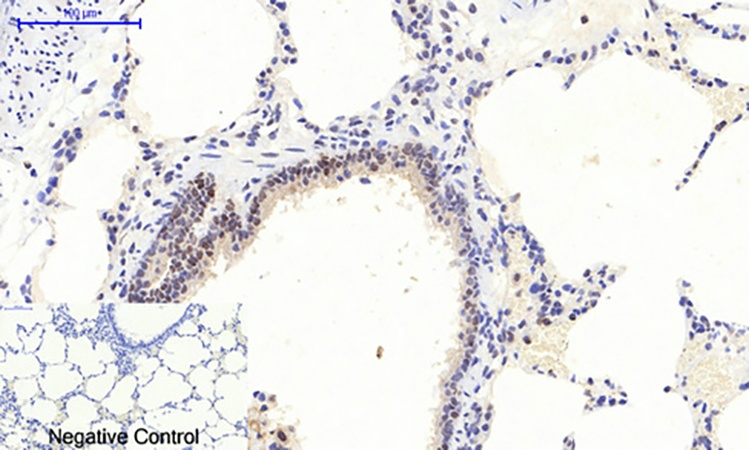 Fig.2. Immunohistochemical analysis of paraffin-embedded rat lung tissue. 1, ERK 1/2 (phospho Thr202/Y204) Polyclonal Antibody was diluted at 1:200 (4°C, overnight). 2, Sodium citrate pH 6.0 was used for antibody retrieval (>98°C, 20min). 3, secondary antibody was diluted at 1:200 (room temperature, 30min). Negative control was used by secondary antibody only.