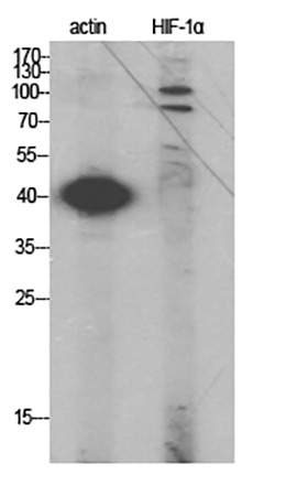 Fig.1. Western Blot analysis of actin (1), HIF-1α (2), diluted at 1:2000.