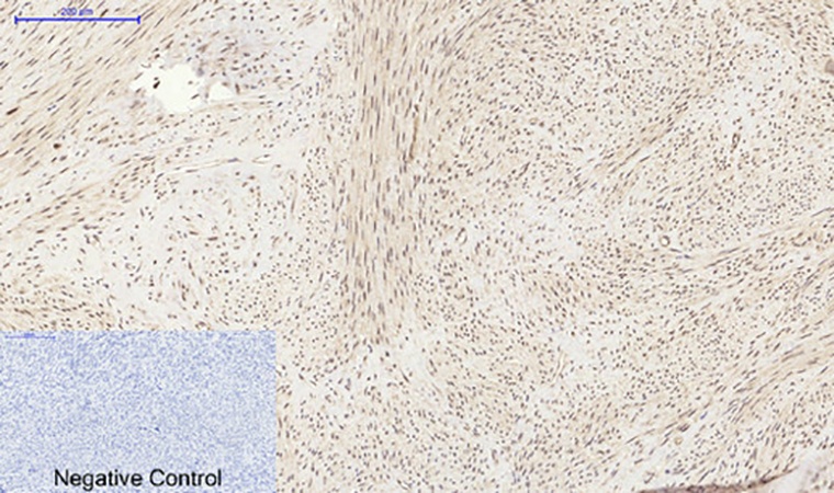 Fig.4. Immunohistochemical analysis of paraffin-embedded human uterus tissue. 1,  PI 3-kinase p85α Polyclonal Antibody was diluted at 1:200 (4°C, overnight). 2,  Sodium citrate pH 6.0 was used for antibody retrieval (>98°C, 20min). 3, secondary antibody was diluted at 1:200 (room temperature, 30min). Negative control was used by secondary antibody only.