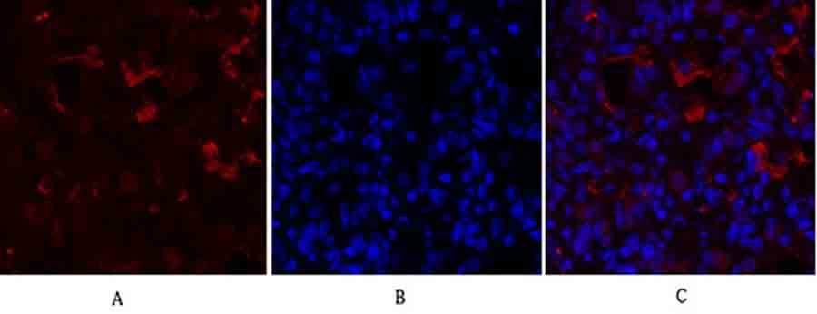 Fig.3. Immunofluorescence analysis of rat lung tissue. 1, PPAR-γ Polyclonal Antibody (red) was diluted at 1:200 (4°C, overnight). 2, Cy3 Labeled secondary antibody was diluted at 1:300 (room temperature, 50min). 3, Picture B: DAPI (blue) 10min. Picture A: Target. Picture B: DAPI. Picture C: merge of A+B.