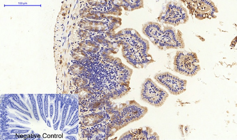 Fig.5. Immunohistochemical analysis of paraffin-embedded mouse colon tissue. 1, PPAR-γ Polyclonal Antibody was diluted at 1:200 (4°C, overnight). 2, Sodium citrate pH 6.0 was used for antibody retrieval (>98°C, 20min). 3, secondary antibody was diluted at 1:200 (room temperature, 30min). Negative control was used by secondary antibody only.