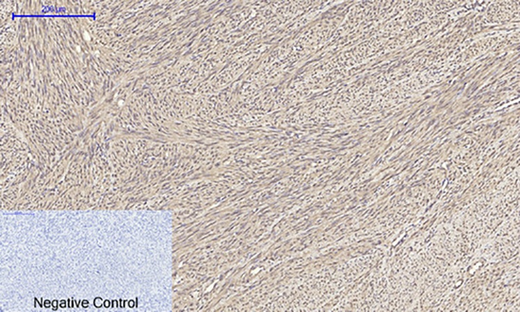 Fig.4. Immunohistochemical analysis of paraffin-embedded human uterus tissue. 1, Tubulin α Polyclonal Antibody was diluted at 1:200 (4°C, overnight). 2, Sodium citrate pH 6.0 was used for antibody retrieval (>98°C, 20min). 3, secondary antibody was diluted at 1:200 (room temperature, 30min). Negative control was used by secondary antibody only.