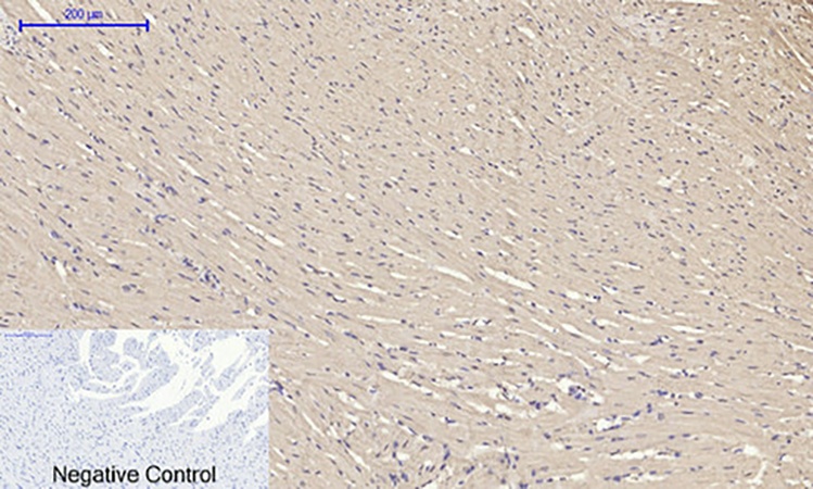 Fig.6. Immunohistochemical analysis of paraffin-embedded rat heart tissue. 1, Tubulin α Polyclonal Antibody was diluted at 1:200 (4°C, overnight). 2, Sodium citrate pH 6.0 was used for antibody retrieval (>98°C, 20min). 3, secondary antibody was diluted at 1:200 (room temperature, 30min). Negative control was used by secondary antibody only.
