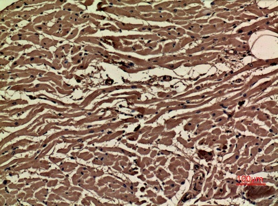 Fig.3. Immunohistochemical analysis of paraffin-embedded human-heart, antibody was diluted at 1:100.