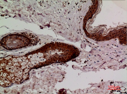 Fig.2. Immunohistochemical analysis of paraffin-embedded human-skin, antibody was diluted at 1:100.