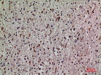 Fig.4. Immunohistochemical analysis of paraffin-embedded human-brain, antibody was diluted at 1:100.