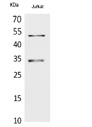 Fig. Western Blot analysis of Jurkat cells using MyoD Polyclonal Antibody. Secondary antibody (catalog#: A21020) was diluted at 1:20000.