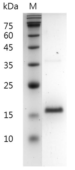 Fig.SDS-PAGE analysis of Human FGF-2（154a，a）protein