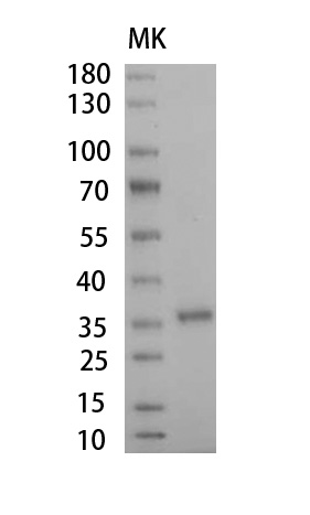 Fig.SDS-PAGE analysis of Human Haptoglobin Protein, His tag