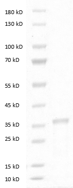 Fig.SDS-PAGE analysis of Human DKK-1 Protein