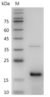 Fig.SDS-PAGE analysis of Mouse/Rat FGF-2 protein