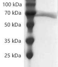 Fig.SDS-PAGE analysis of Human CD73/NT5E protein, His tag