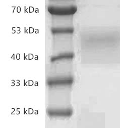 Fig.SDS-PAGE analysis of Human CD84/SLAMF5 protein, His tag