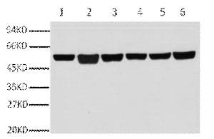 A01030-1.jpg&&Fig.1. Western blot analysis of A549(1), rat brain (2), mouse brain (3), chicken lung (4) and rabbit testis(5), sheep muscle(6), diluted at 1:10000.|||A01030-2.jpg&&Fig.2. Immunofluorescence analysis of human appendix tissue. 1, β-Tubulin Monoclonal Antibody (3G6) (red) was diluted at 1:400 (4°C, overnight). Picture A: Target. Picture B: DAPI. Picture C: merge of A+B.|||A01030-3.jpg&&Fig.3. Immunofluorescence analysis of mouse lung tissue. 1, β-Tubulin Monoclonal Antibody (3G6) (red) was diluted at 1:400 (4°C, overnight). Picture A: Target. Picture B: DAPI. Picture C: merge of A+B.|||A01030-4.jpg&&Fig.4. Immunohistochemical analysis of paraffin-embedded human colon tissue. 1, β-Tubulin Monoclonal Antibody (3G6) was diluted at 1:400 (4°C, overnight). Negative control was used by secondary antibody only.|||A01030-5.jpg&&Fig.5. Immunohistochemical analysis of paraffin-embedded mouse testis tissue. 1, β-Tubulin Monoclonal Antibody (3G6) was diluted at 1:400 (4°C, overnight). Negative control was used by secondary antibody only.|||A01030-6.jpg&&Fig.6. Immunohistochemical analysis of paraffin-embedded rat lung tissue. 1, β-Tubulin Monoclonal Antibody (3G6) was diluted at 1:400 (4°C, overnight). Negative control was used by secondary antibody only.