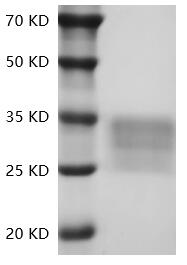 PRP2033.jpg&&Fig.SDS-PAGE analysis of Human CD7/GP40 protein