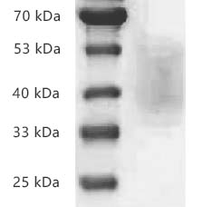 PRP2038.jpg&&Fig.SDS-PAGE analysis of Human CD226/DNAM-1 protein, His tag