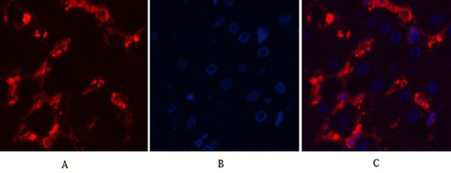 α-SMA-IHC