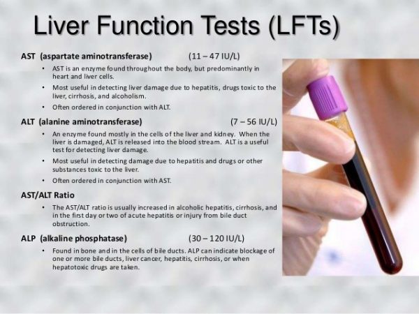 liver-function-tests-lfts-liver-function-test-interpretation